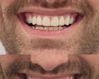 קרדיט התמונה: jerusalemdentalclinic.com