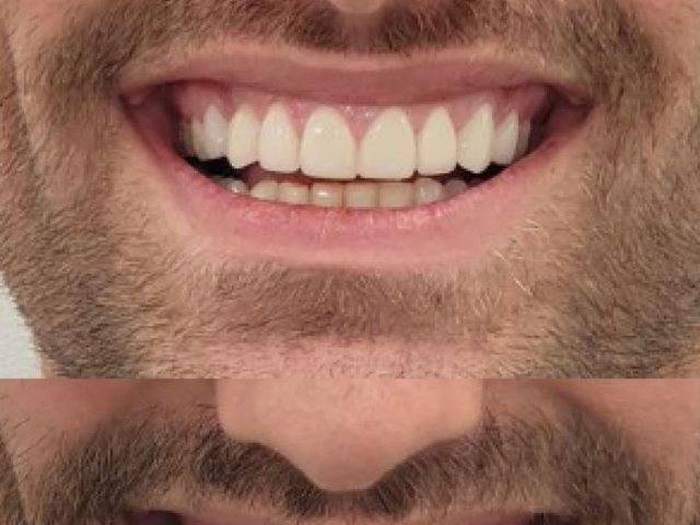 קרדיט התמונה: jerusalemdentalclinic.com